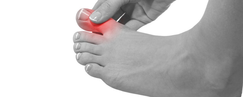 Stiff Big Toe Podiatrist Saint Louis