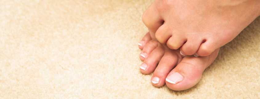 Hammertoe Doctor St. Louis